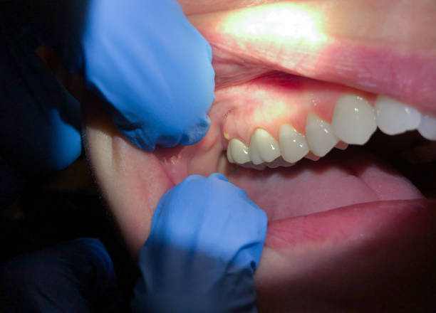 Best Mobile Emergency Dentist in Fruit Hill, OH